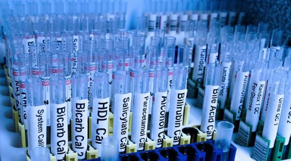 Blockchain Smart Contracts: A Hyper-Deflationary Force for Health Care Delivery 1